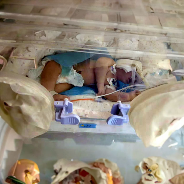 2023年河南二七区康复回家到平顶山市湛河区急救车电话